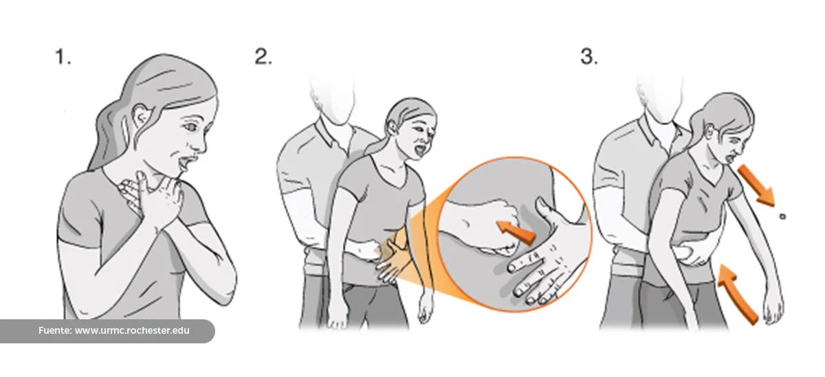 Emergencia por atragantamiento: Cómo es la maniobra de Heimlich que puede salvarte si estas solo o ayudar a otro